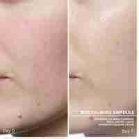 AMPOULES - SOS calming