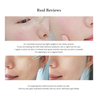Dr. Althea Skin Relief Essence – אסנס משקם להרגעת העור, הפחתת אדמומיות וחיזוק מחסום ההגנה (30ml)