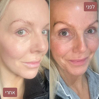 מסכת קולגן למיצוק וזוהר מיידי – Medicube Collagen Night Wrapping Mask