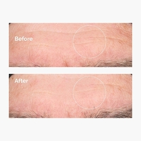 The Ordinary Hyaluronic Acid 2% + B5 – סרום חומצה היאלורונית וויטמין B5 ללחות אינטנסיבית ונפח לעור (30ml)