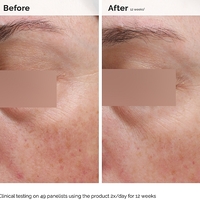 The Ordinary Niacinamide 5% Face and Body Emulsion – תחליב ניאצינמיד 5% לפנים ולגוף להבהרה, איחוד גוון וחיזוק העור (100ml