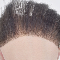 PU-FRONTAL