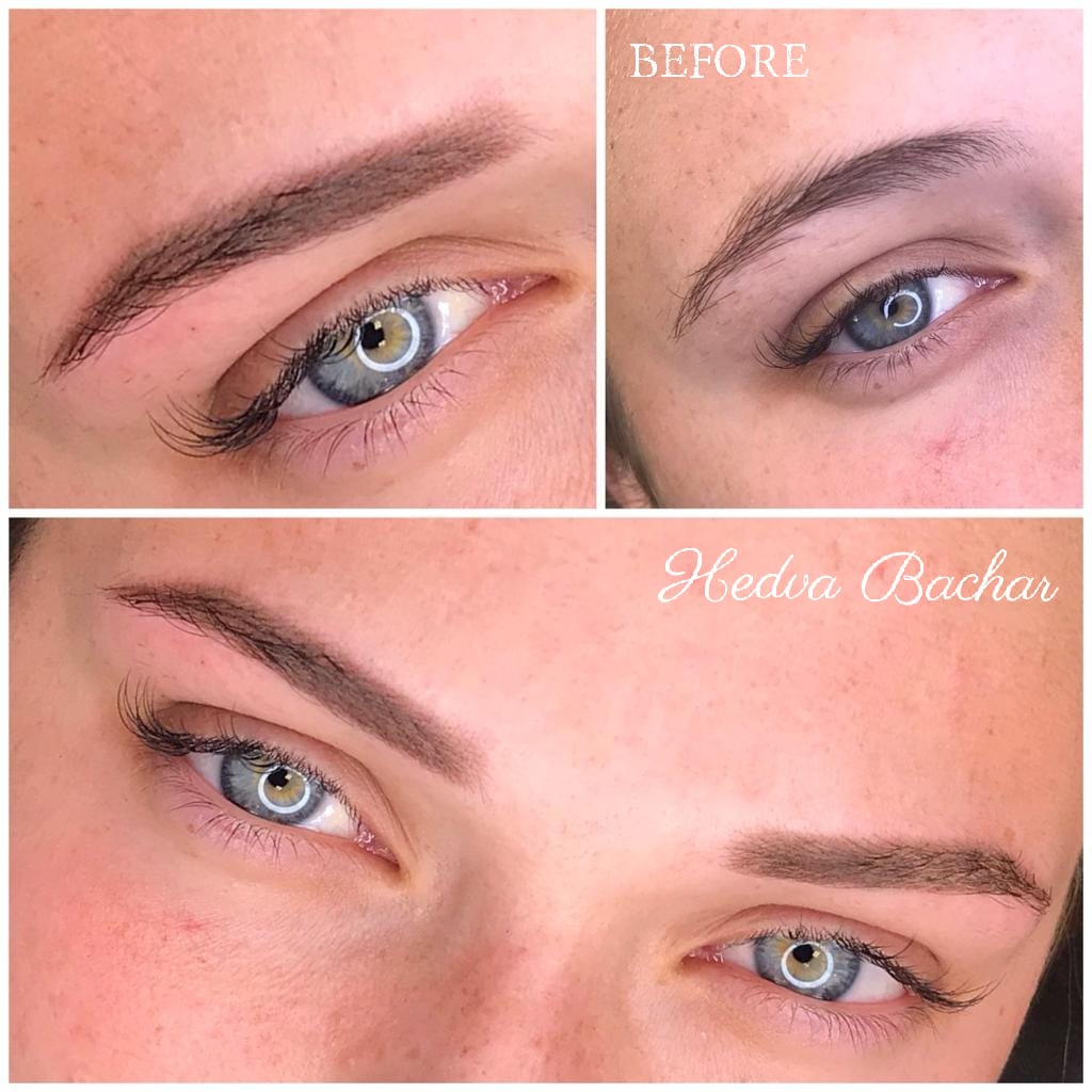 תוצאות הצללת פודרה לפני ואחרי בנתניה אצל חדווה בכר