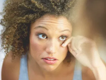 טיפול בכהויות ונפיחות מתחת לעיניים בנתניה עם ביופטרון, NOON ו-KB PURE