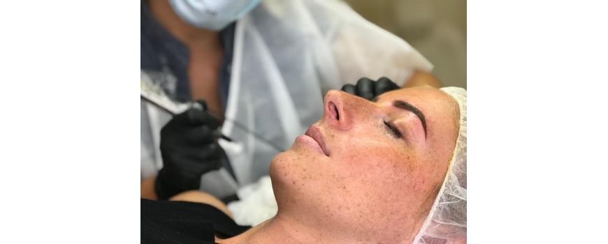 שיטת השערה MICROBLADING