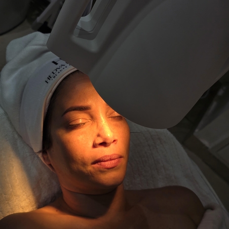 הבהרת פיגמנטציה בנתניה | חדווה בכר HBeauty