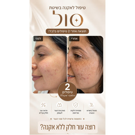 טיפול אקנה