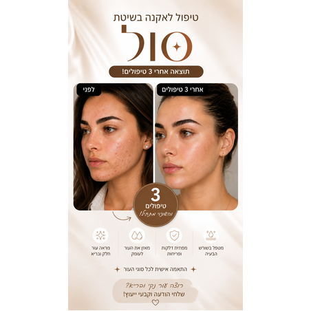 טיפול אקנה