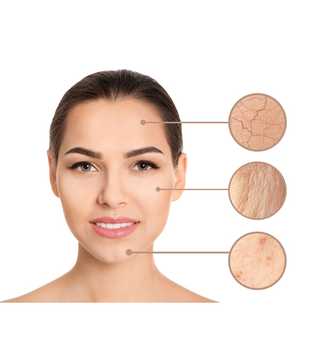 טיפול פנים - קלאסי