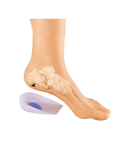 ITEM 307 – עקב סיליקון לדורבן בתוספת הגנה אחורית