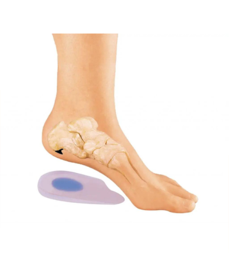 ITEM 308 – עקב סיליקון לדורבן עם הנקודה הכחולה