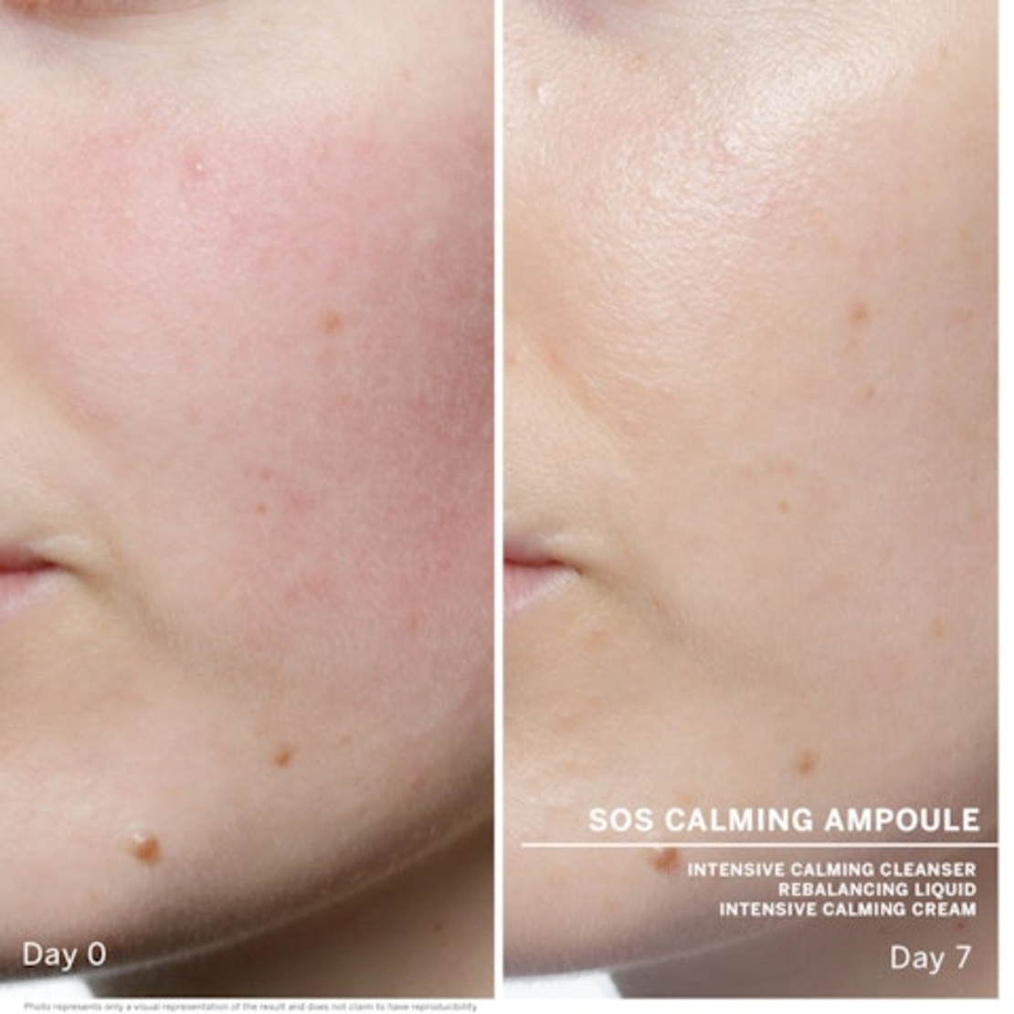 AMPOULES - SOS calming