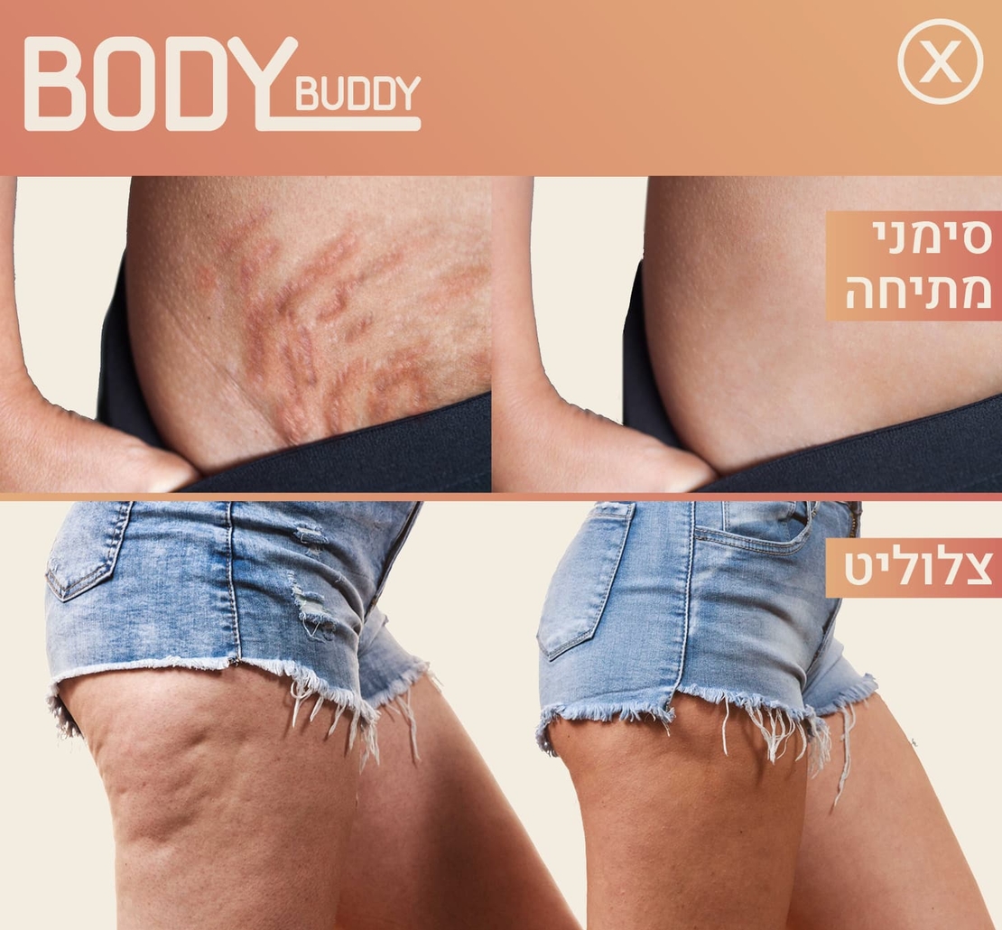 BODY TREATMENTS - BODY BUDY CELLULITE PEEL