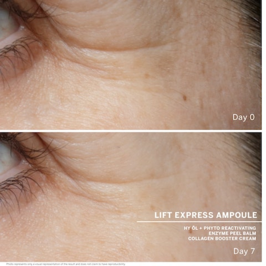 AMPOULES - Lift express