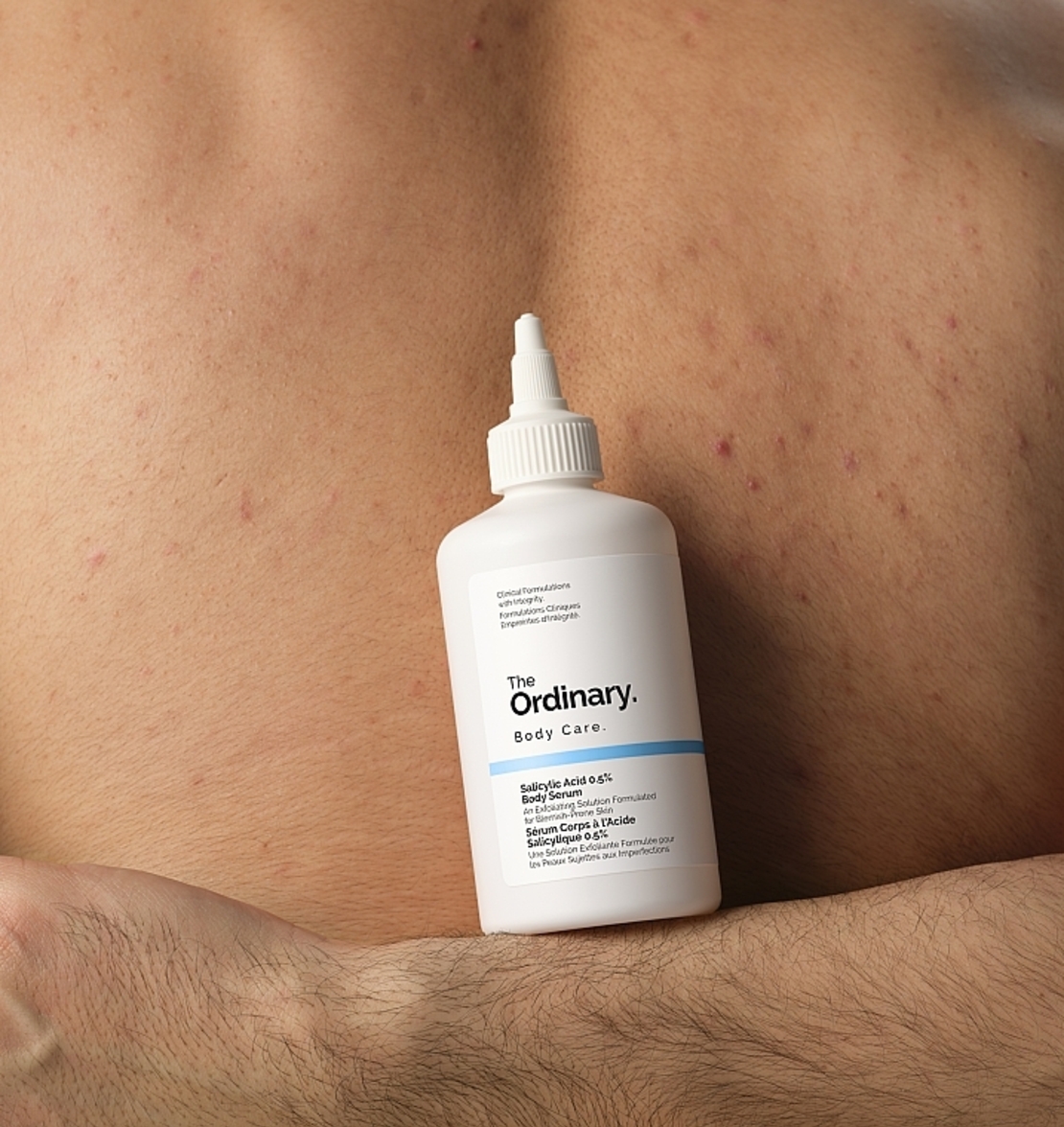 The Ordinary Salicylic Acid 0.5% Body Serum – סרום חומצה סליצילית לגוף לטיפול בפגמי עור, אקנה וחידוש המרקם (240ml