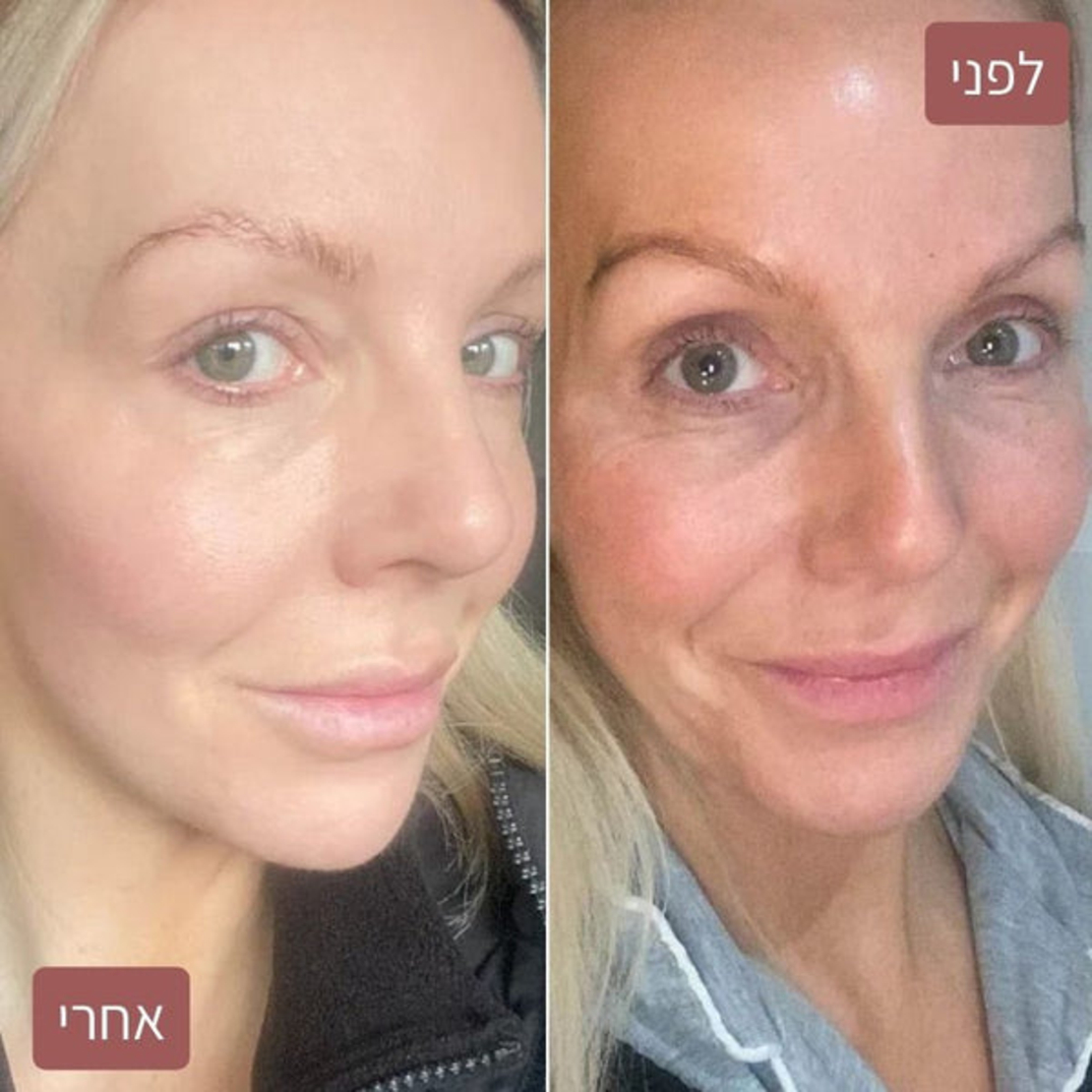 מסכת קולגן למיצוק וזוהר מיידי – Medicube Collagen Night Wrapping Mask