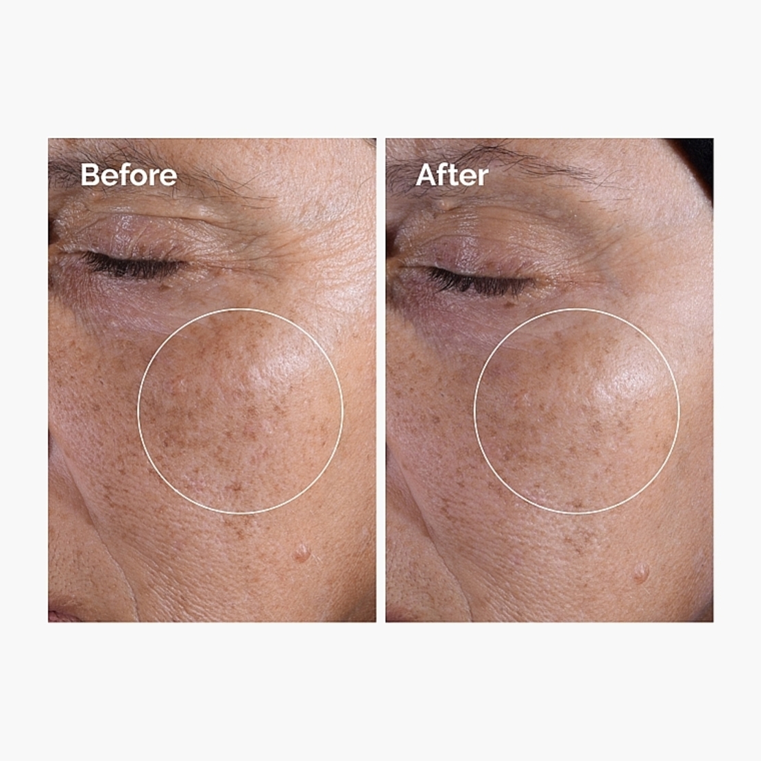 The Ordinary Glycolic Acid 7% Exfoliating Toner – טונר חומצה גליקולית לחידוש מרקם העור, הבהרה וזוהר יוצא דופן