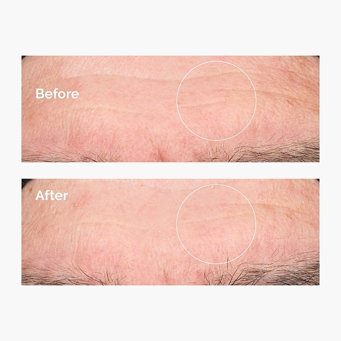 The Ordinary Hyaluronic Acid 2% + B5 – סרום חומצה היאלורונית וויטמין B5 ללחות אינטנסיבית ונפח לעור (30ml)