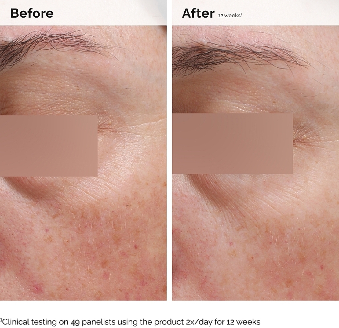 The Ordinary Niacinamide 5% Face and Body Emulsion – תחליב ניאצינמיד 5% לפנים ולגוף להבהרה, איחוד גוון וחיזוק העור (100ml