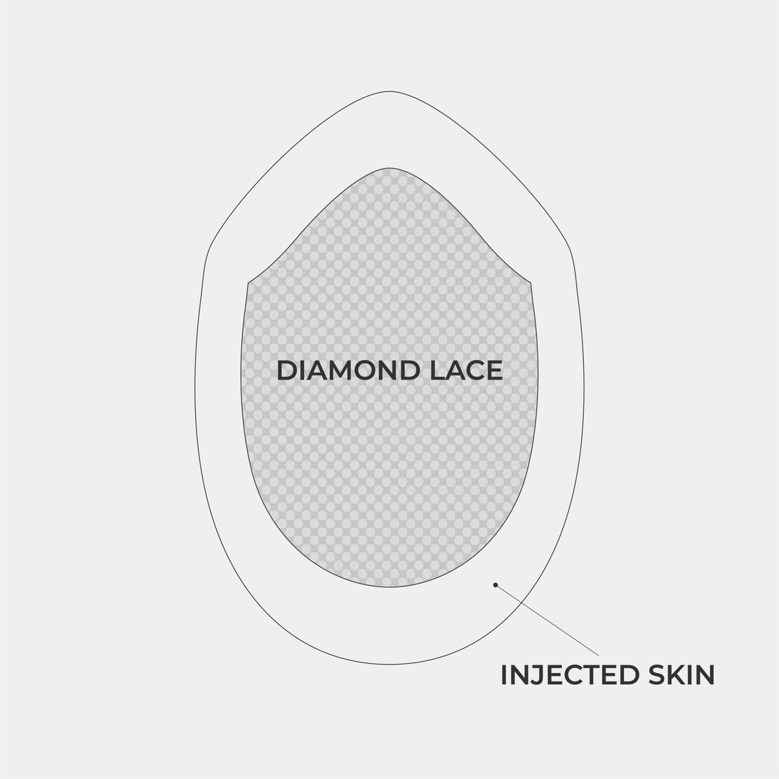 INL