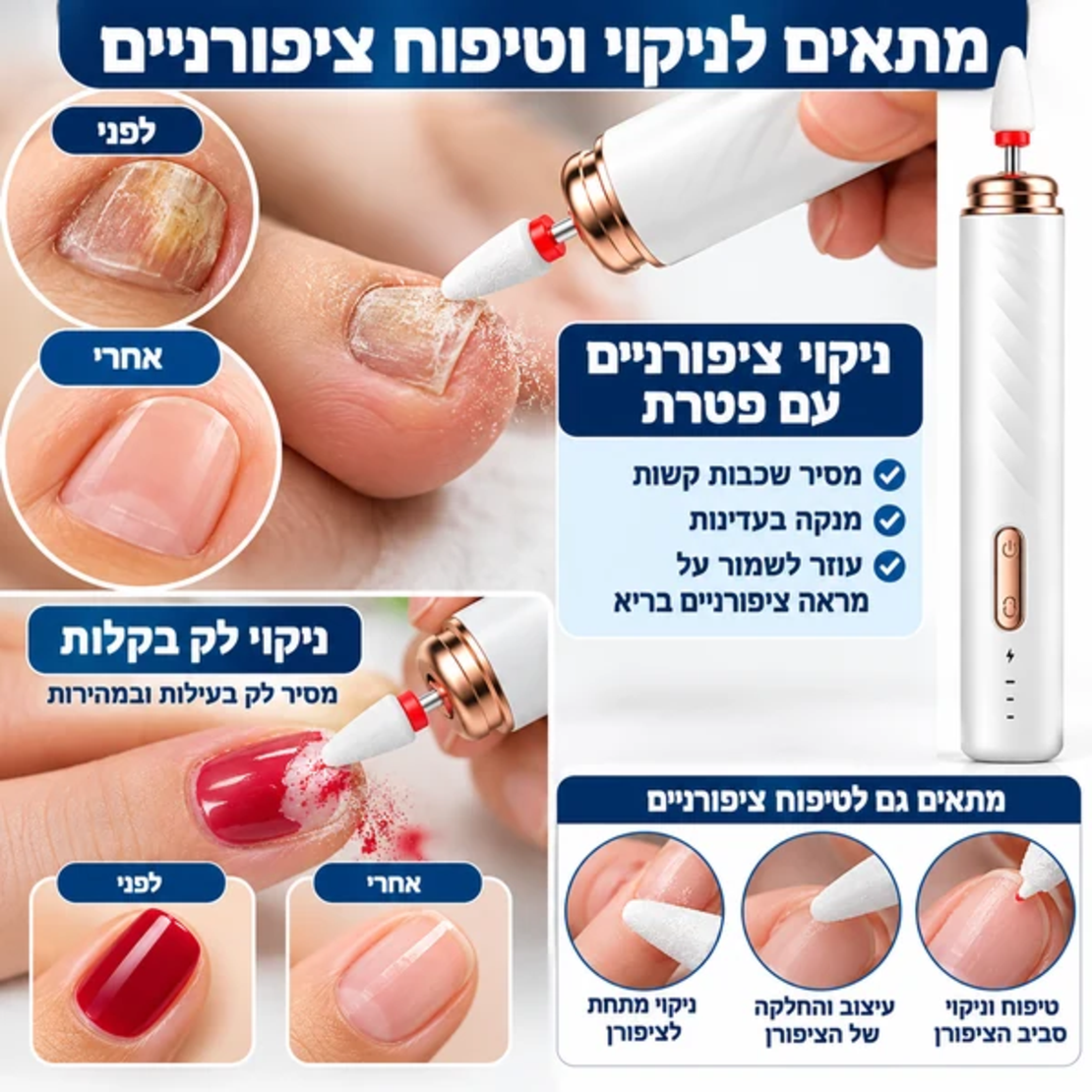ALT מומלץ: מכשיר פדיקור נטען GoodMix – המחשת ניקוי ציפורניים עם פטרת והסרת לק, כולל תמונות לפני ואחרי.