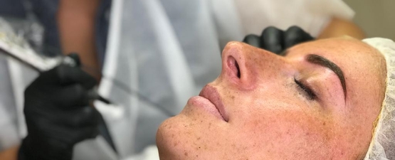 שיטת השערה MICROBLADING