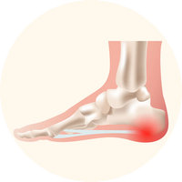 נעליים לדורבן בעקב - פתרון לנשים וגברים