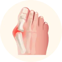 נעליים להלוקס ולגוס - פתרון לנשים וגברים